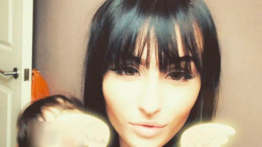 Se tiñó el pelo para su cumpleaños y terminó con la cara desfigurada por una reacción alérgica