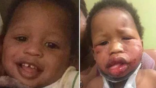 Brutal paliza a un bebé en una guardería de Estados Unidos: la maestra culpó a una nena de 2 años