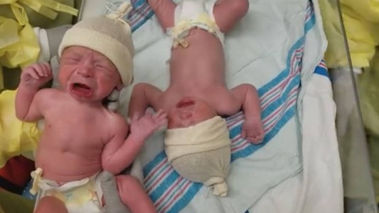 Video pura ternura: los gemelos recién nacidos que dejan de llorar cuando se unen