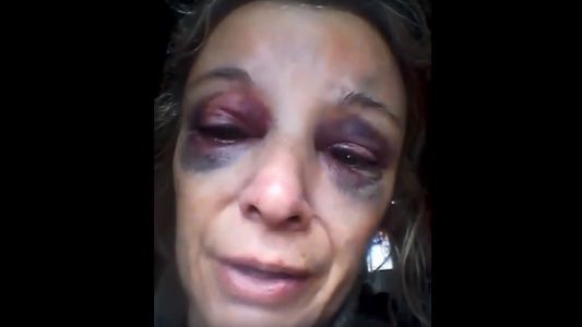 El desgarrador pedido de ayuda de una mujer a la que le pegaron un ladrillazo por negarse a tener sexo
