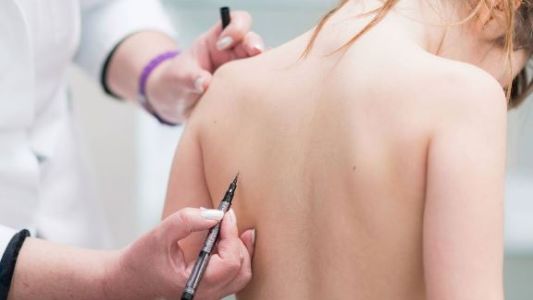 Escoliosis: buscan incluir su detección en los controles de salud de los colegios