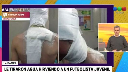 Un hincha quemó a un jugador juvenil con agua hirviendo