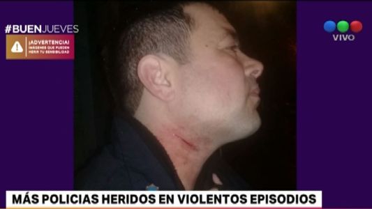 Policías bonaerenses fueron heridos en episodios violentos