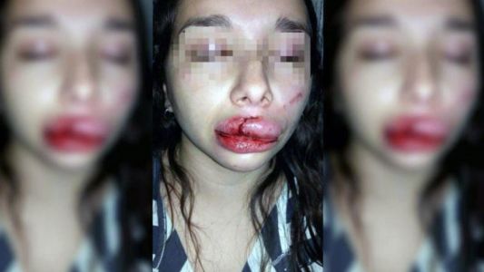 Santiago del Estero: tres hombres intentaron violarla y le desfiguraron la cara con un hierro