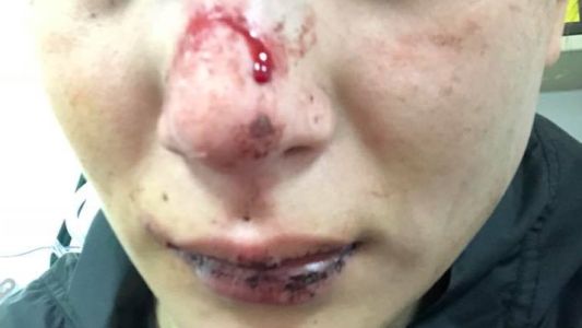 Denunció que su exnovio le dio una paliza en la calle: "Espero poder volver a sonreír"