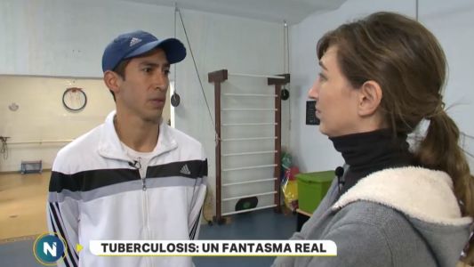 Tuberculosis: la enfermedad que resiste desde el pasado
