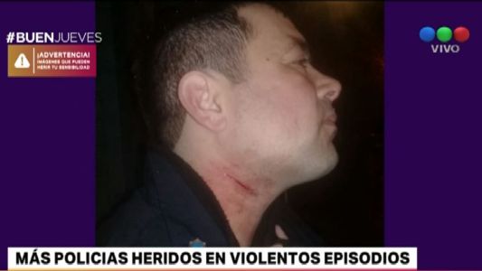Policías bonaerenses fueron heridos en episodios violentos