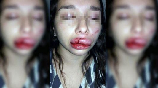 Santiago del Estero: tres hombres intentaron violarla y le desfiguraron la cara con un hierro