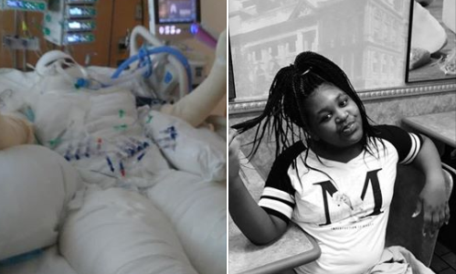 Una nena de 12 años terminó con quemaduras en la mitad de su cuerpo tras hacer un reto viral