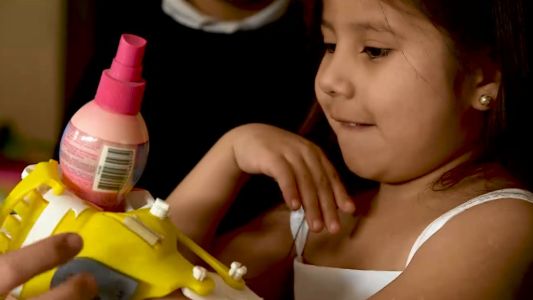 Abril recibió una prótesis de mano que le va a cambiar la vida