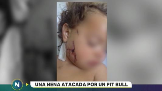 Una nena de 3 años fue atacada por dos pitbulls
