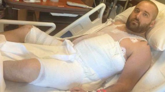 Intentó tener sexo con un cerco eléctrico y se le quemaron los genitales