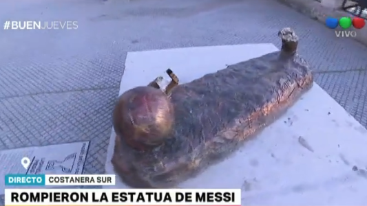 A Messi le cortaron las piernas y repararlas cuesta 28 millones de pesos