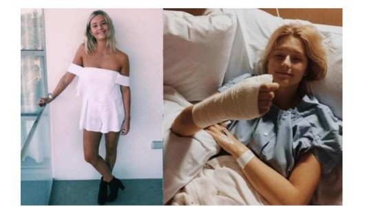 Le amputaron un dedo por comerse las uñas durante años