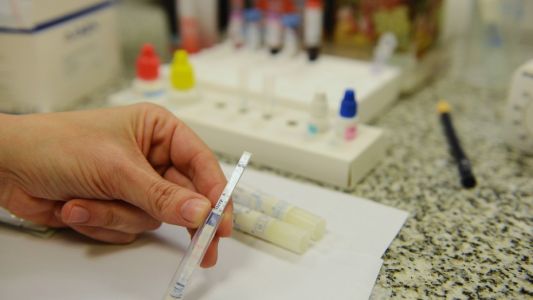 Informe oficial: para el Malbrán las pruebas en la bacteria son "tranquilizadoras"