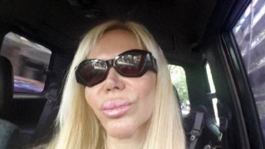 Alejandra Pradón se hizo un rejuvenecimiento vaginal para las cámaras de un reality show