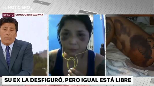 "Nadie la daba importancia, ni la Policía ni la fiscal": pide ayuda para que su ex no la mate