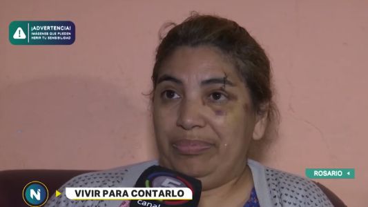 El dramático relato de la mujer que fue aplastada con su auto por un acoplado