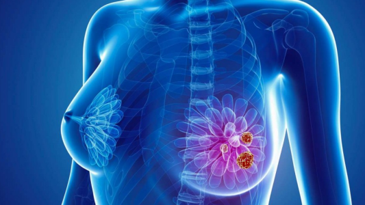 Mes del cáncer de mama: hábitos saludables, mamografías y nuevas terapias