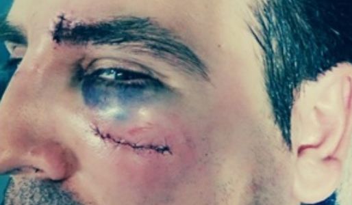 Fotos: así quedó tras la golpiza el preceptor denunciado por acoso