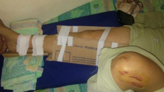 Denuncian que ante la falta de insumos “enyesan” con cartones