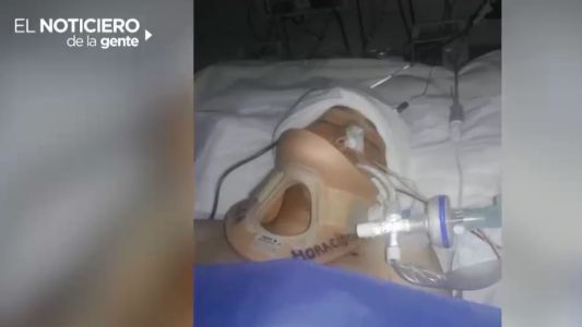 Menor está en coma tras ser atropellado por un automovilista que huyó