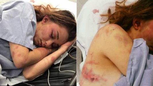 Detuvieron a un karateca por una brutal golpiza a su pareja