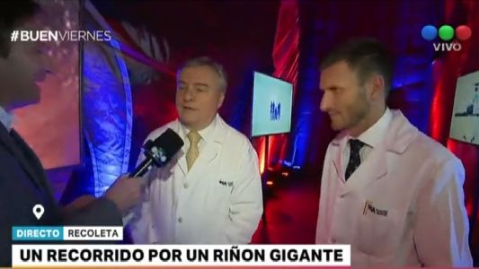 Riñón gigante para concientizar sobre la prevención de dolencias renales