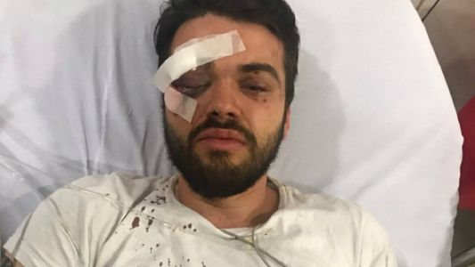 Le dieron una brutal paliza a un rugbier por ser gay y ahora cumplirán condena en un colegio trans
