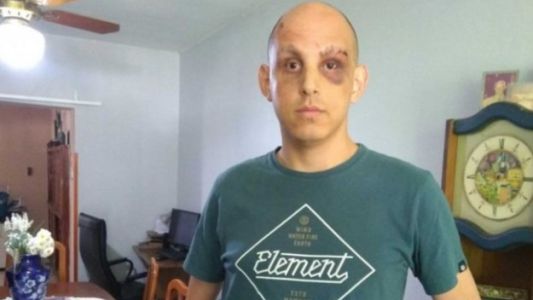 Brutal golpiza a un joven por ser gay en un boliche de Ramallo