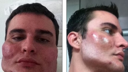 Brasil: así dejaba las caras de sus pacientes "el cirujano del terror"