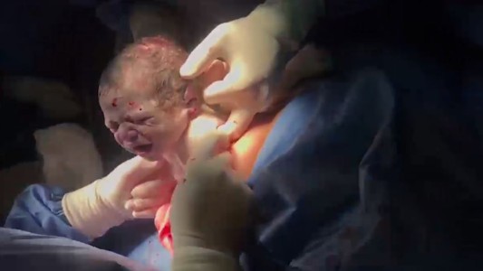 Video: así fue la cesárea de Vicky Xipolitakis