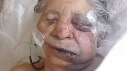 Tres detenidos por el asesinato a golpes de una mujer de 83 años