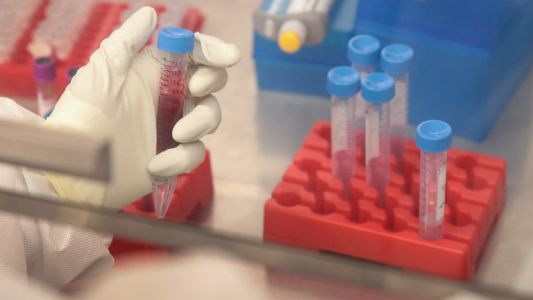 Descubren una fórmula para eliminar el virus del sida