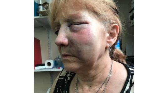 Motochorros golpearon y arrastraron a una mujer de 68 años en Morón