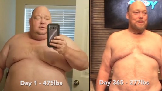 El caso del hombre que tenía obesidad mórbida y bajó 90 kilos en un año