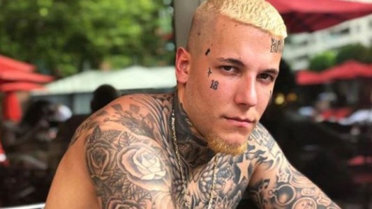 Fotos: así le quedó la cara a Alex Caniggia tras su operación de nariz