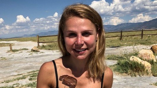 Increíble pero real: pasó de ser vegana a carnívora por la picadura de una araña