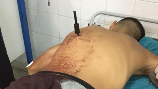 Robó, una mujer lo corrió y lo acuchilló por al espalda
