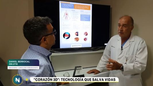 Implantan una válvula aórtica con planificación virtual por primera vez en el país
