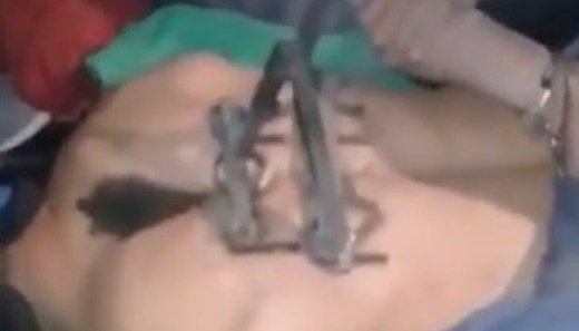 Video: el momento en el que marcan a un ladrón en la espalda con un fierro caliente