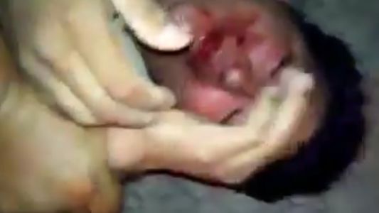 Citaron a un hombre que acosaba a una nena de 13 años y le dieron una paliza