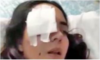 Sobrevivió al ataque de su ex porque se hizo la muerta: "Me salía humo de la espalda"
