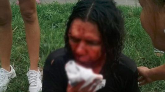 Tucumán: un hombre fue atacado a ladrillazos por ser gay