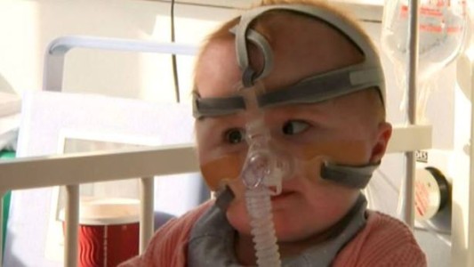 El bebé milagroso que sobrevivió pese a nacer con el corazón fuera del pecho