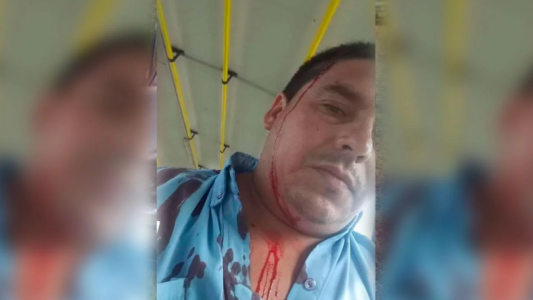 Un colectivero fue baleado con una escopeta en Moreno