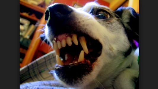 Un perro fuera de control atacó a una chica, le dieron 40 puntos de sutura