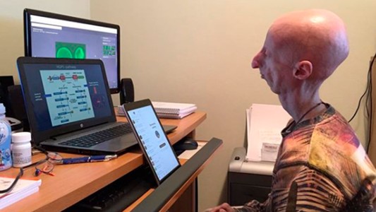 El biólogo que sufre de envejecimiento prematuro y busca una cura para su enfermedad