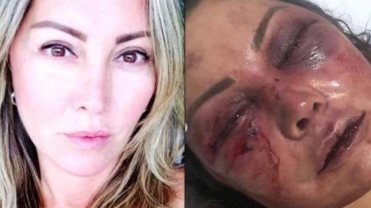 Se conocieron por redes y en la primera cita le dio una brutal paliza: golpes y mordiscos