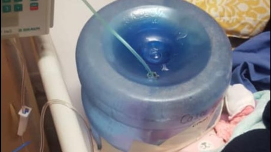 Denuncia viral: usaron un bidón de agua como máscara de oxígeno para una recién nacida